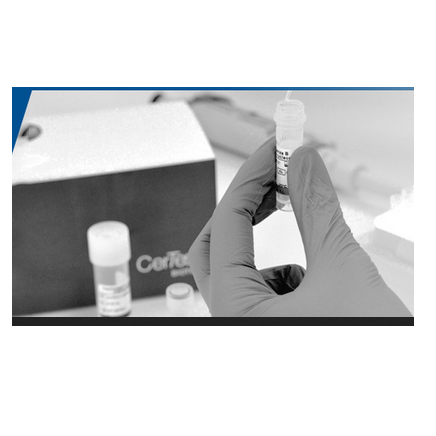 Certest™ Influenza B Recombinant Nucleoprotein (x1mg)
