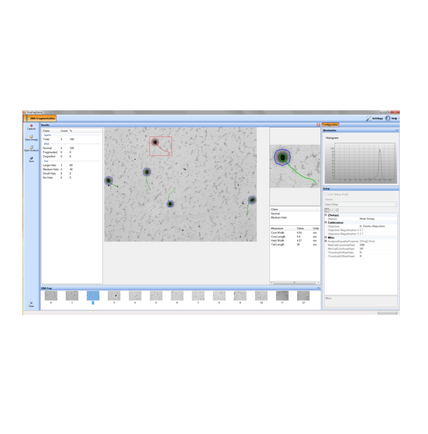 Hamilton DNA Fragmentation, Automated Sperm Chromatin Dispersion Measurement Software